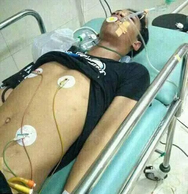 14歲少年被自己眼鏡王蛇咬到拍照炫耀，12小時(shí)后慘死