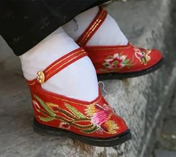 古代傳統極端纏足文化照片，X光看起來太可怕！